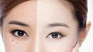 獨(dú)家揭秘！了解重慶楊武林醫(yī)生的墊下巴整形全過程