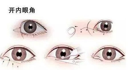 廣州畸形耳朵手術(shù)？值得收藏的醫(yī)院推薦！