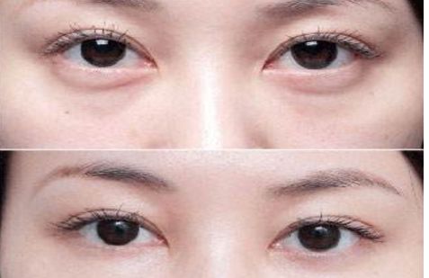 沈陽(yáng)哪個(gè)醫(yī)院的整形專家口碑好，醫(yī)術(shù)高超的醫(yī)生推薦