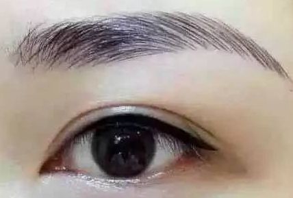 各路醫(yī)生實(shí)力大比拼！同帥與楊亞益，誰在雙眼皮手術(shù)上更出彩？