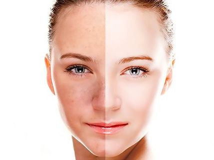 深圳米蘭柏羽整形醫(yī)院王志東醫(yī)生雙眼皮價(jià)格及成功案例分享 深圳米蘭柏羽整形醫(yī)院王志東醫(yī)生雙眼皮價(jià)格及成功案例分享