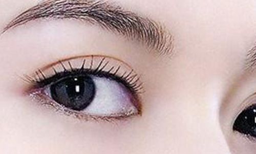 太玲美眸重現(xiàn)！揭秘雙眼皮新趨勢，驚艷效果讓人眼前一亮