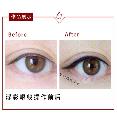 華美整形醫(yī)院在廣州口碑如何？高順福、袁耀東醫(yī)生值得信賴嗎？