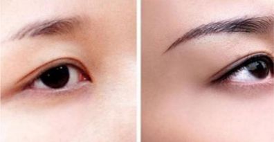 重慶頂尖眼部整形醫(yī)生、醫(yī)院排行榜一覽