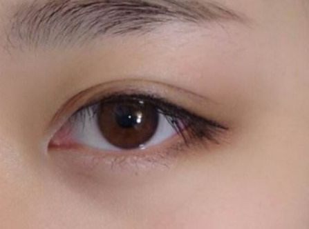 杭州任東做鼻部整容效果如何？MD技術(shù)解析真實(shí)案例分享！