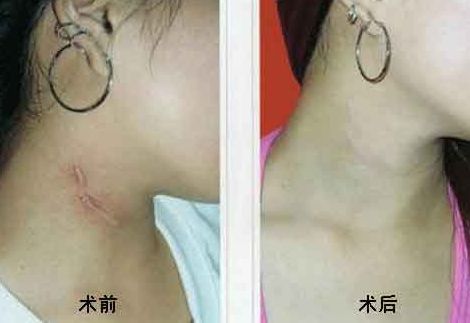 重慶乳房整形六大權(quán)威醫(yī)生盤點，高素質(zhì)專家排行曝光