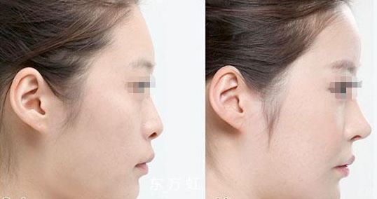 蘇州無線頻率融脂?？漆t(yī)生排名前十這幾位醫(yī)術(shù)聲譽超卓的醫(yī)生是您的不二之選
