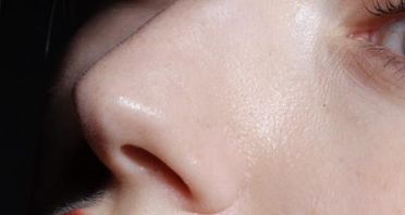 廣州植發(fā)領先的醫(yī)院推薦【技術認證方面有哪些】 廣州植發(fā)領先的醫(yī)院推薦【技術認證方面有哪些】