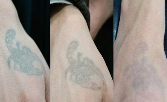 長(zhǎng)沙哪家整形醫(yī)院技術(shù)靠譜？私立醫(yī)美還可信嗎？