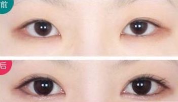 全國(guó)頂級(jí)整形醫(yī)院奉上前十年度最佳隆胸選擇！專(zhuān)業(yè)可靠服務(wù)，平價(jià)優(yōu)惠！
