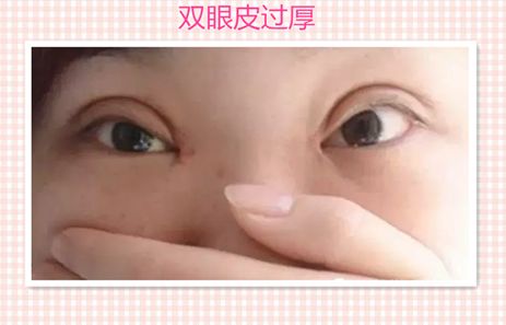 鄭州東方整形醫(yī)院大腿吸脂術:醫(yī)生解讀及成功案例分享 鄭州東方整形醫(yī)院大腿吸脂術:醫(yī)生解讀及成功案例分享