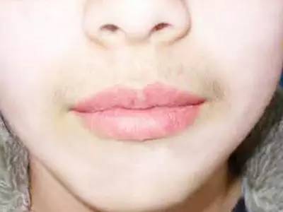 無錫三院整形科哪位醫(yī)生會更受關注？