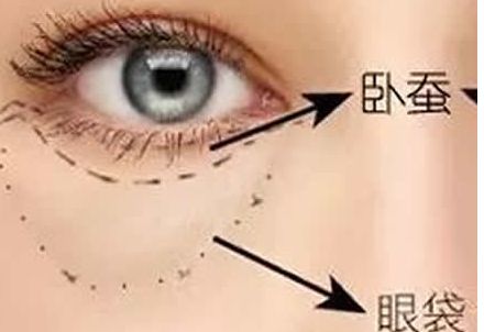 北京協(xié)和醫(yī)院隆胸案例與醫(yī)生簡介含金量如何？收費是否合理？