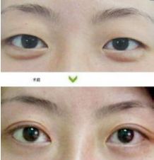 成都哪些醫(yī)生能力出眾進(jìn)行隆胸術(shù)？年度隆胸好醫(yī)生十大排名出爐