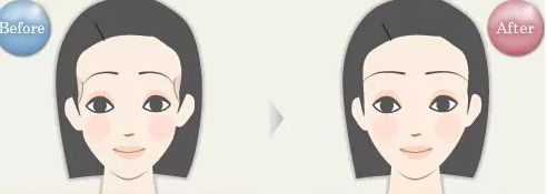揭密石家莊哪位雙眼皮醫(yī)生備受關(guān)注，優(yōu)點(diǎn)揭秘，價(jià)格參考！