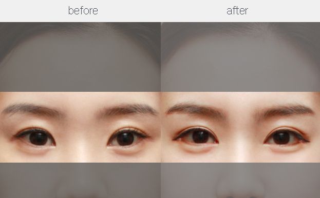【特約】重慶鼻整形手術修復醫(yī)生五強名單揭曉，專家推薦！