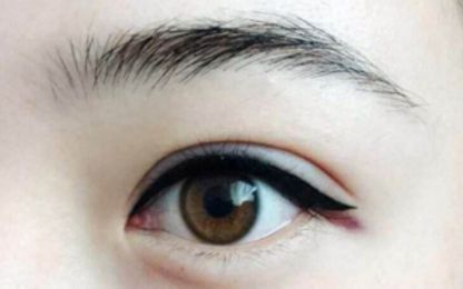 南寧醫(yī)科大雙眼皮整形費(fèi)用及技術(shù)綜述！名單與收費(fèi)指南分享