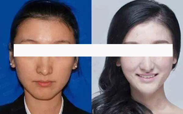 寧波藝星整形和珈禾整形，哪家更具實力？醫(yī)生口碑、項目擅長和地址公布等方面的對比如何？