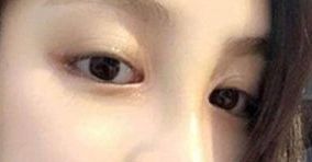如何選擇合適的醫(yī)生，讓你的身材變得完美無暇