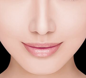 哈醫(yī)大四院李巍主治醫(yī)生鼻整形手術(shù)！80天重塑完美鼻型全記錄！