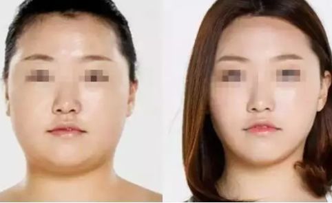 寧波2023年抽脂醫(yī)生排名揭曉！這幾位口碑爆棚的專家堪稱翹楚！