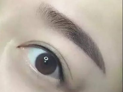 杭州整形美容醫(yī)院-網(wǎng)友贊不絕口！成就您華麗的容顏