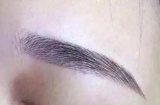 長沙脂肪吸取專家揭秘：技術(shù)卓越，無數(shù)口碑背后的醫(yī)美奇跡！