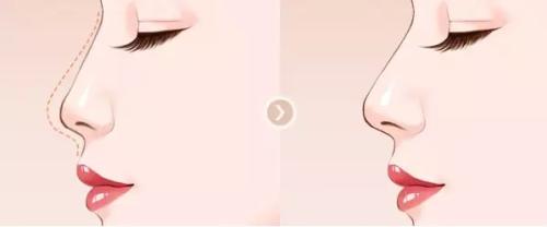 寧波韓美整形吸脂值得信賴嗎？