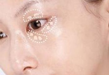 吳毅平醫(yī)生坐診醫(yī)院及隆胸案例分享，詳細介紹！