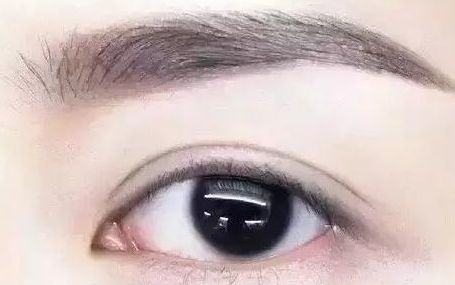 全國哪位專家值得信賴修復(fù)雙眼皮手術(shù)？頂級(jí)醫(yī)生排行榜首推名單揭曉