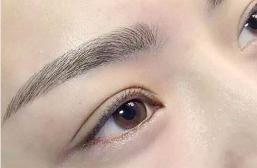 眼袋手術(shù)費用及醫(yī)生評價與項目分析？