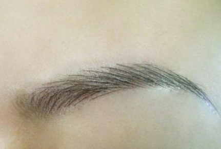 上海九院墊下巴誰的技術(shù)好？魏皎醫(yī)生真人案例和價格均價對比可信嗎？