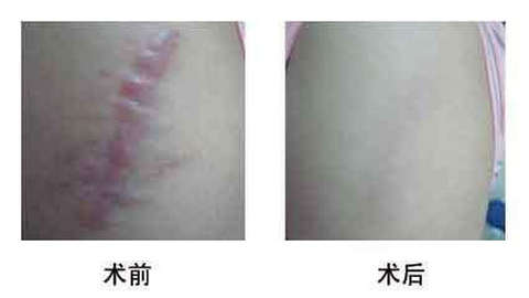 濟(jì)南有哪些人氣更高的美容整形醫(yī)院海峽和旭美如何評價(jià) 濟(jì)南有哪些人氣更高的美容整形醫(yī)院海峽和旭美如何評價(jià)