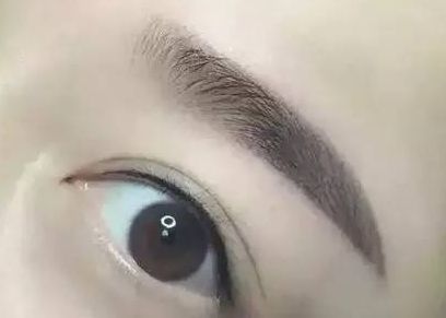 醫(yī)生楊明勇：從技術(shù)實力到用戶評價揭秘，提眉案例評價出乎預(yù)料！