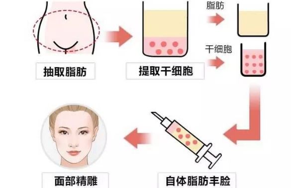 從醫(yī)生個人資料到豐胸案例圖對比，揭秘王沛森的豐胸效果！