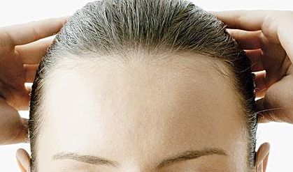 郭建玲雙眼皮修復(fù)費(fèi)用揭秘！看真實(shí)案例圖分享，了解其技術(shù)效果！