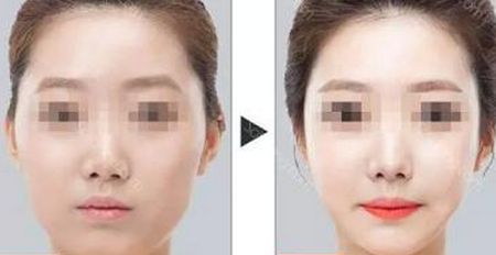 石家莊最受歡迎的除皺美容醫(yī)院排名榜前六來(lái)襲！2023年超贊抗衰除皺全攻略！