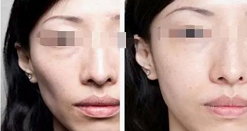 廈門整容醫(yī)院實力排名揭曉，輕松擁有美麗容顏！