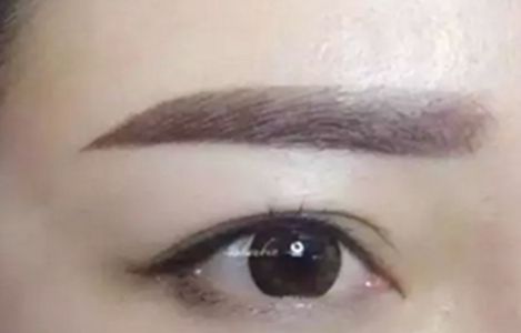 南昌美伊爾醫(yī)院的劉立軍醫(yī)生手術(shù)實(shí)力如何？擅長哪些手術(shù)？附真實(shí)案例為參考