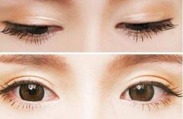 青島壹美天成整形醫(yī)院的隆鼻技術(shù)如何？看看這些真實(shí)案例！