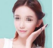 首屈一指的北京瘦身?？漆t(yī)院排行榜