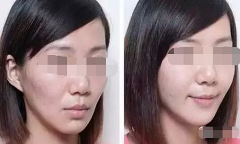 北京哪些醫(yī)院能進行吸脂手術？
