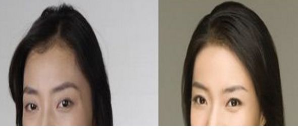 成都悅己醫(yī)美醫(yī)生實(shí)力強(qiáng)，顧客口碑好價格合適