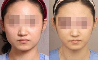 湛江有哪些頂尖整形美容醫(yī)院值得關(guān)注？