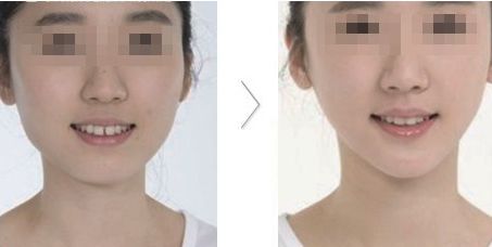 哪家醫(yī)院在北京具有卓越的醫(yī)美科技和服務(wù)？歐洲醫(yī)學(xué)中心、北京協(xié)和、北大人民醫(yī)院等公立單位有何特色？