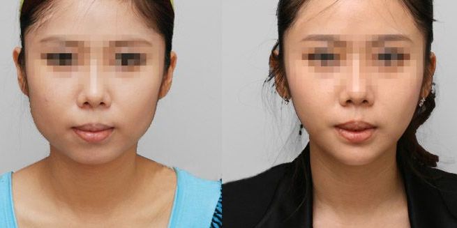 蘭州哪家整形醫(yī)院口碑好？看看排名榜單！