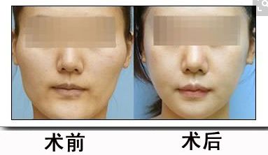 北京醫(yī)院2024年磨骨治療醫(yī)院盤(pán)點(diǎn) 北京醫(yī)院2024年磨骨治療醫(yī)院盤(pán)點(diǎn)