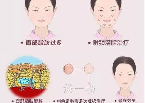 徐州二院整形美容科專家評(píng)價(jià)及服務(wù)項(xiàng)目介紹，陶常波醫(yī)生特長領(lǐng)域一覽