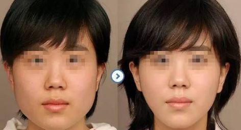 【揭秘】合肥私立整形醫(yī)院人氣TOP榜單！