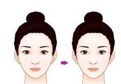 深圳哪家醫(yī)院的隆鼻效果好？醫(yī)生口碑怎么樣？